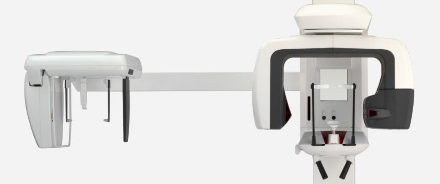 3D画像で確認できる“歯科用CT”