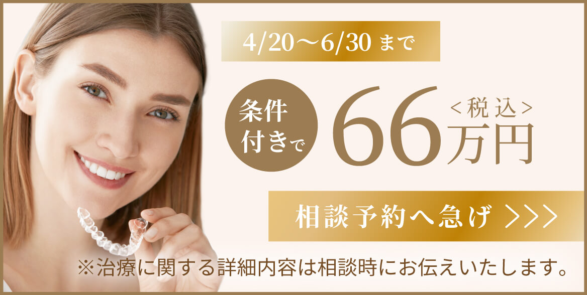 4/20〜6/30まで 条件付きで66万円