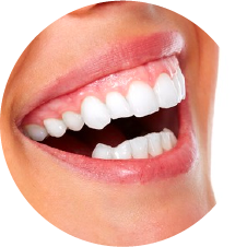 歯茎の整形