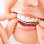 歯科医師が思う歯列矯正の本当の価値
