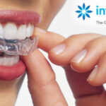 当院矯正装置｜Invisalign の特徴