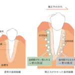 矯正治療中の痛みと対処法について