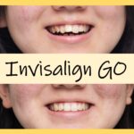【治療例】部分矯正 Invisalign GO