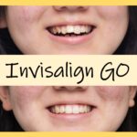 【治療例】部分矯正 Invisalign GO